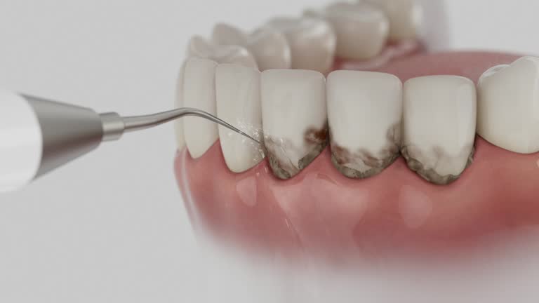 Reliable Tooth Extraction contractor in Giles County County, VA by Dentist Open Now